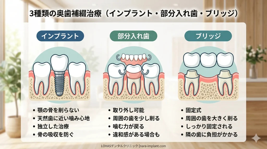 奥歯2本の治療法を比較|インプラント・部分入れ歯・ブリッジ