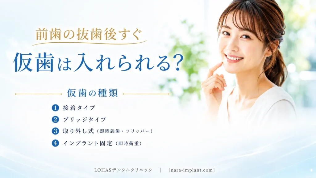 前歯の抜歯後に入れられる仮歯の種類と特徴