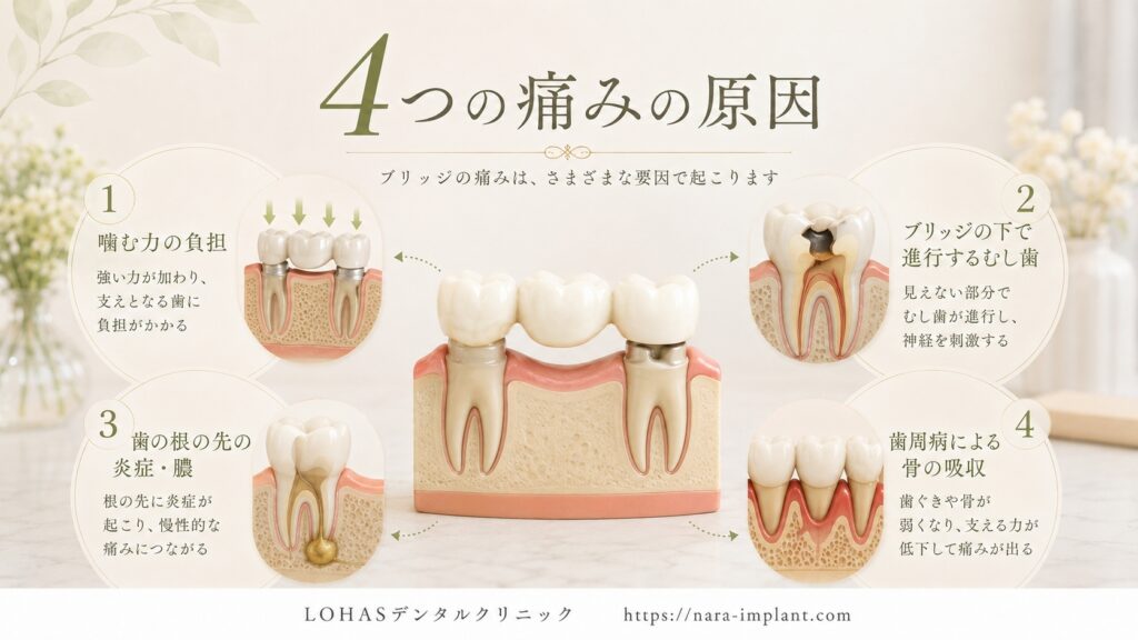 考えられる4つの痛みの原因