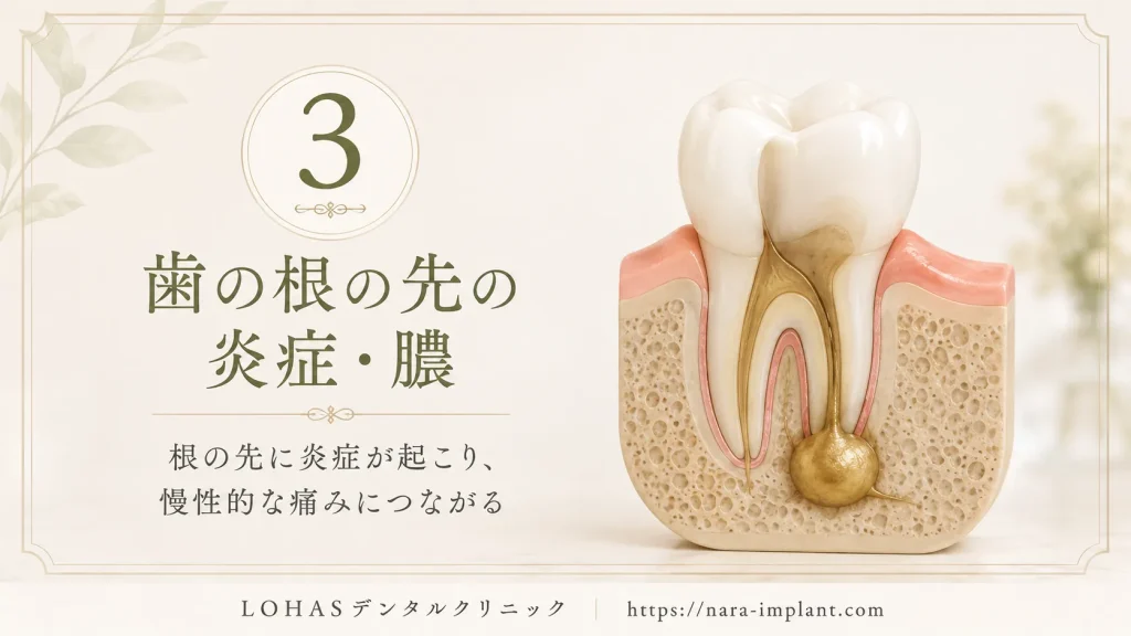 原因③:歯根の先端に膿がたまり、慢性的な炎症が続いている