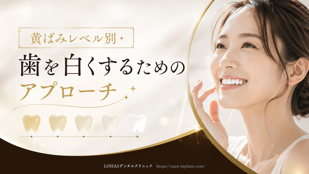 黄ばみレベル別・歯を白くするためのアプローチ