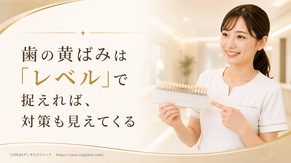 まとめ:歯の黄ばみは「レベル」で捉えれば、対策も見えてくる