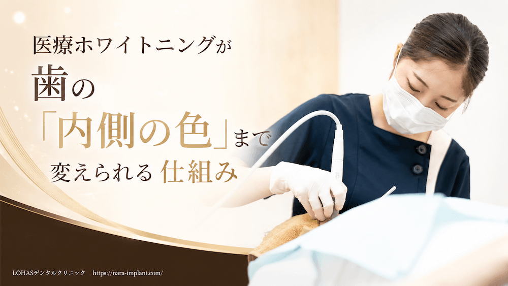 医療ホワイトニングが歯の「内側の色」まで変えられる仕組み