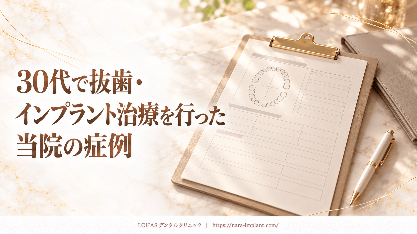 30代で抜歯・インプラント治療を行った当院の症例